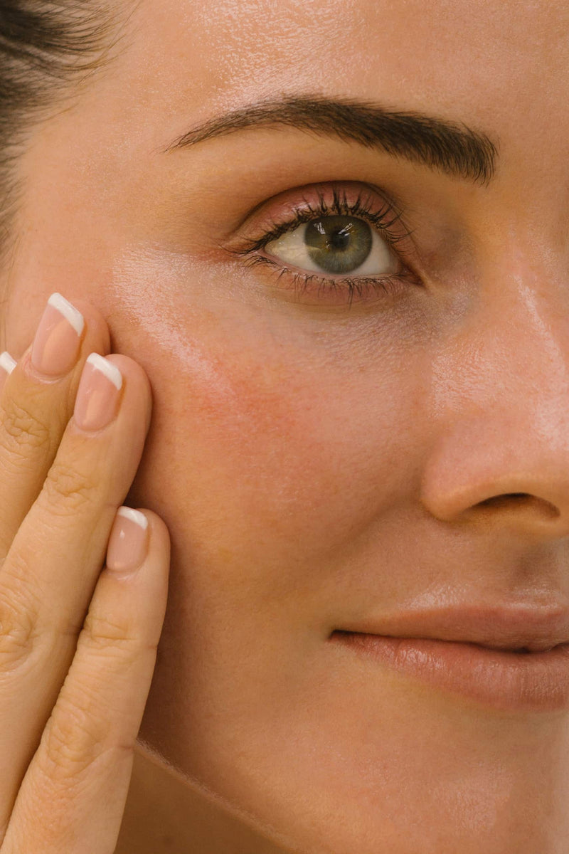 What’s Your Problem? Acne