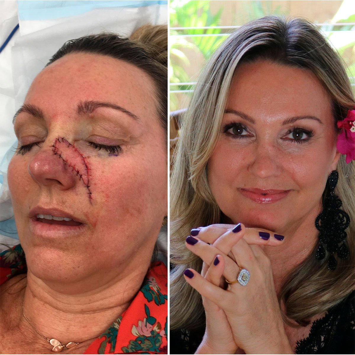 Removing the reminder - Eco By Sonya Europe