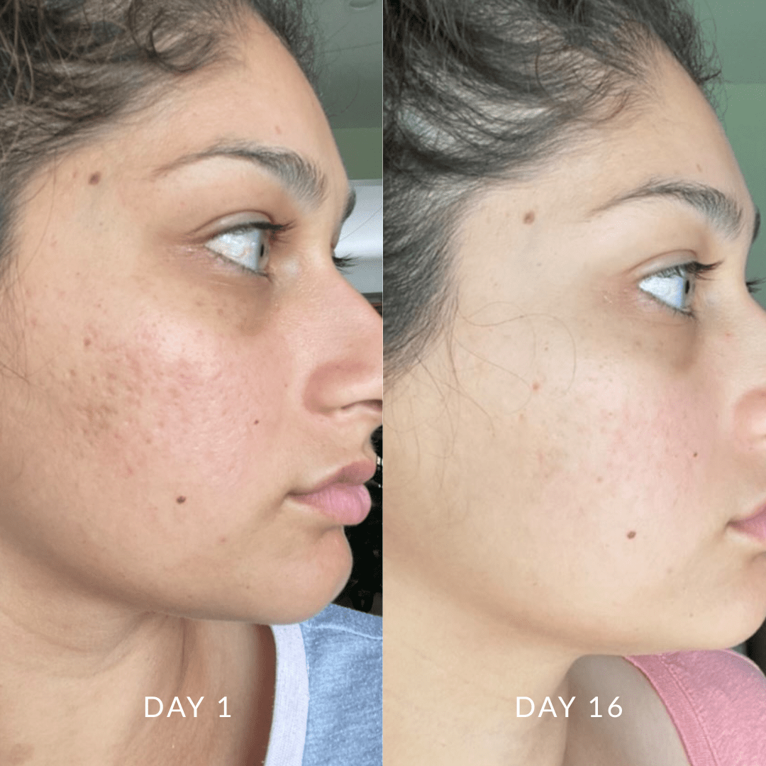 Hydration Skin System