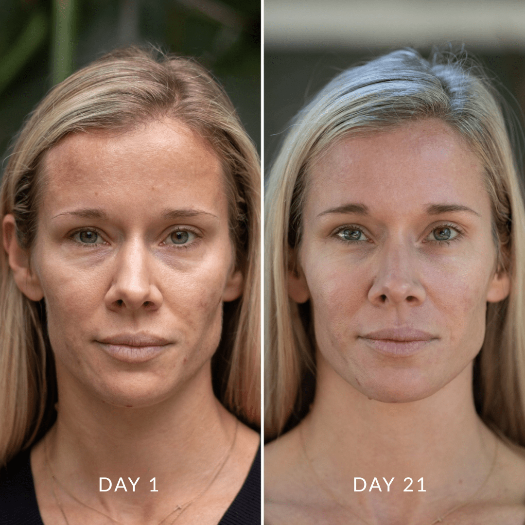 Hydration Skin System