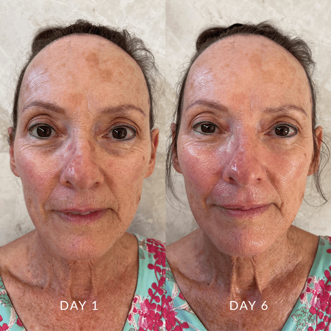 Hydration Skin System