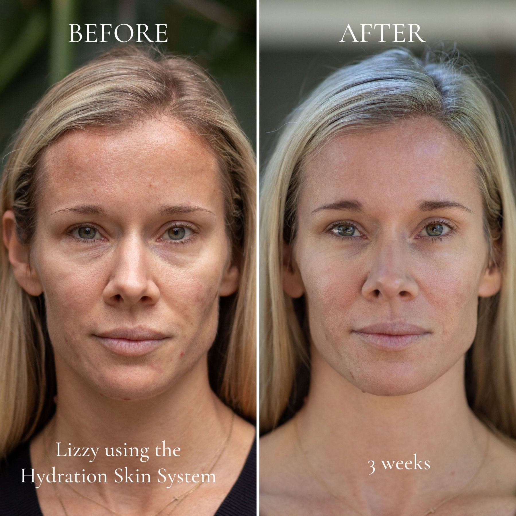 Hydration Skin System - Eco By Sonya Driver Europe